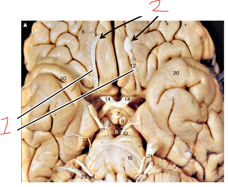 <p>what are 1?</p>