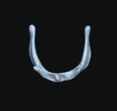 name the bone 