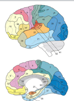 <p>auditory </p>