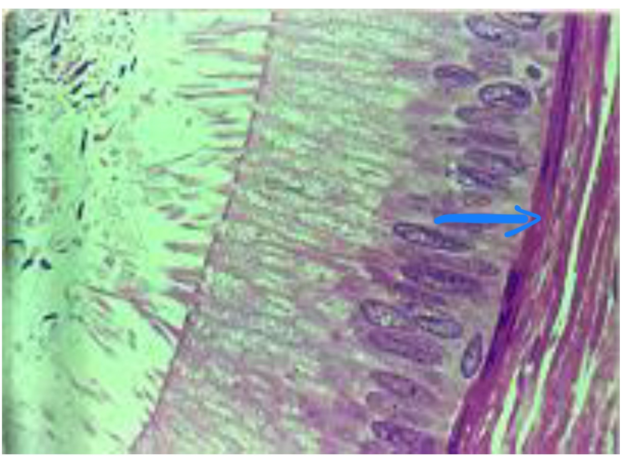 term image