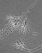 <p><span>Mycelium forms a pitchfork structure and may or may not have spores attached at the end.</span></p>