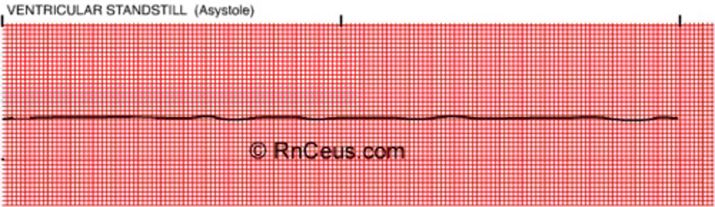 <p>- dead</p><p>- no electrical activity, only straight line (no rate/pulse)</p><p>A dire form of cardiac arrest in which the heart stops beating -- there is no systole -- and there is no electrical activity in the heart. The heart is at a total standstill.</p>