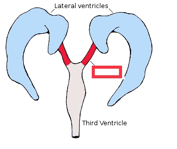 openings between the lateral ventricles and third ventricle allowing for the passage of CSF