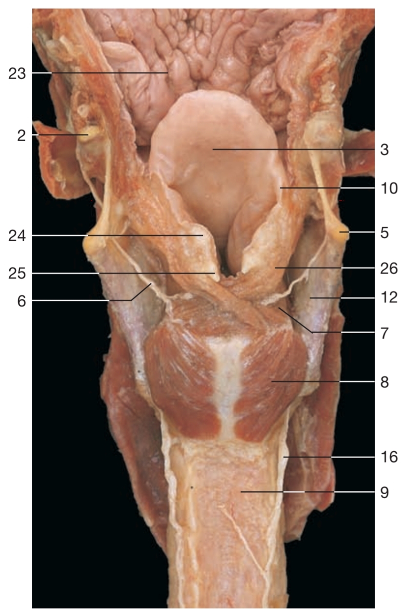 <p>23</p>