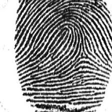 <p>Finger Print type that forms a small loop shape </p>