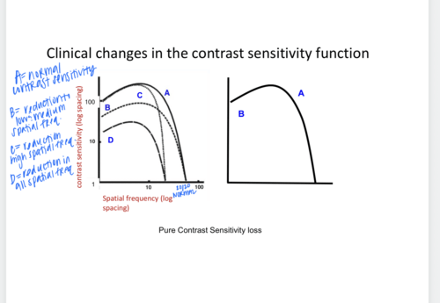 <p>Clinical Changes in the Contrast Sensitivity Function</p><p>What does A line depict?</p>