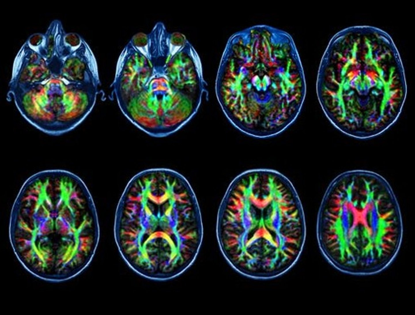 <p>What type of scan is this?</p>