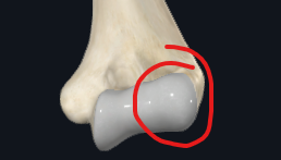 <p>What is this part of the humerus called?</p>