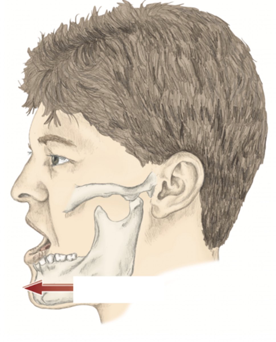 <p>please identify the movement and its location</p>