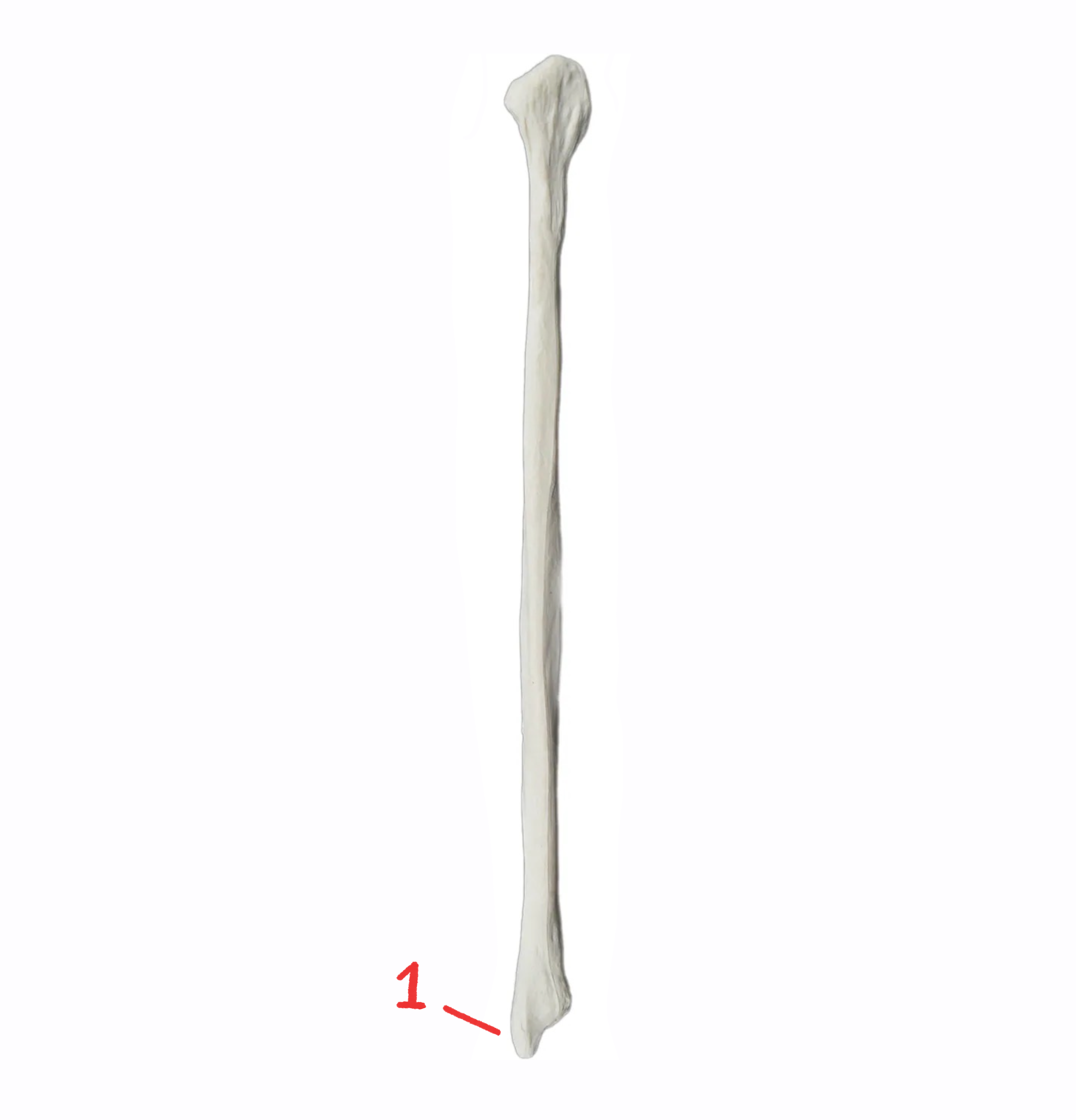 <p>What is this bone?</p>