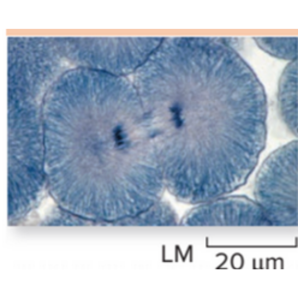 <p>What kind of cell is shown? Name the phase that it is experiencing.</p>