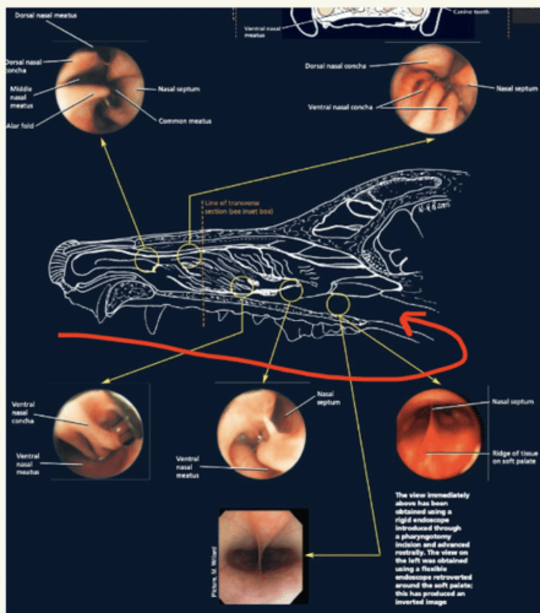 <p>retrogada (meto un rinoscopio no rígido en la boca y va en la cavidad nasal por la coana)</p><p>la anterogada hace sangrada y es con rinoscopio rígido</p>