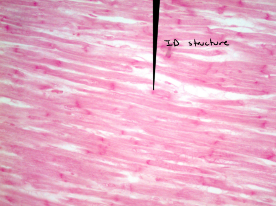 <p>Identify this image </p>