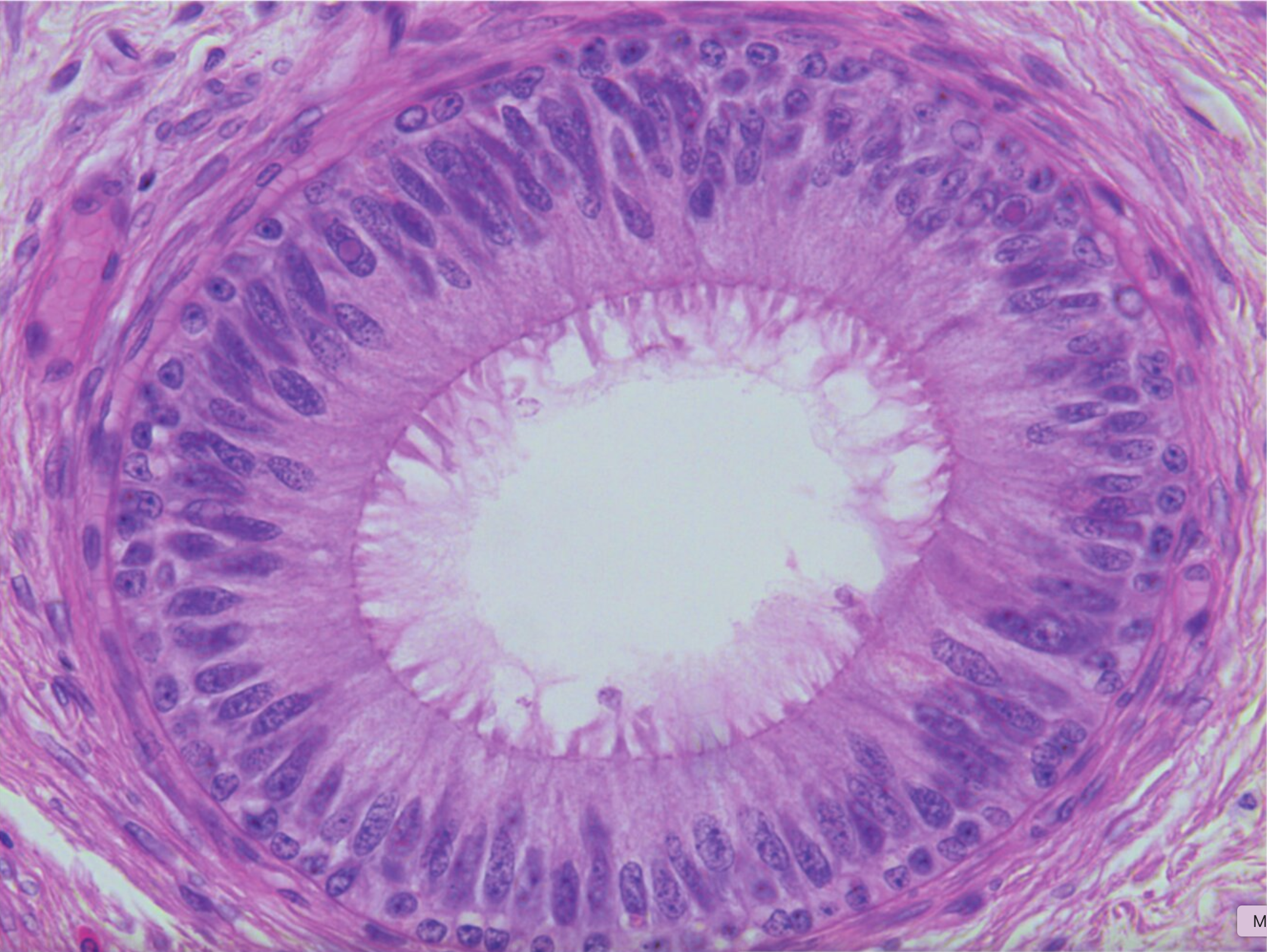 <p>9. The image shows a section of a histological slide of an organ.</p><p>Which statement best describes the function or characteristic of this organ?</p><p>A. It serves in the absorption of nutrients.</p><p>B. It stores sperm cells.</p><p>C. It transports egg cells.</p><p>D. It transports urine.</p><p>E. Its epithelium is involved in mucociliary clearance.</p>