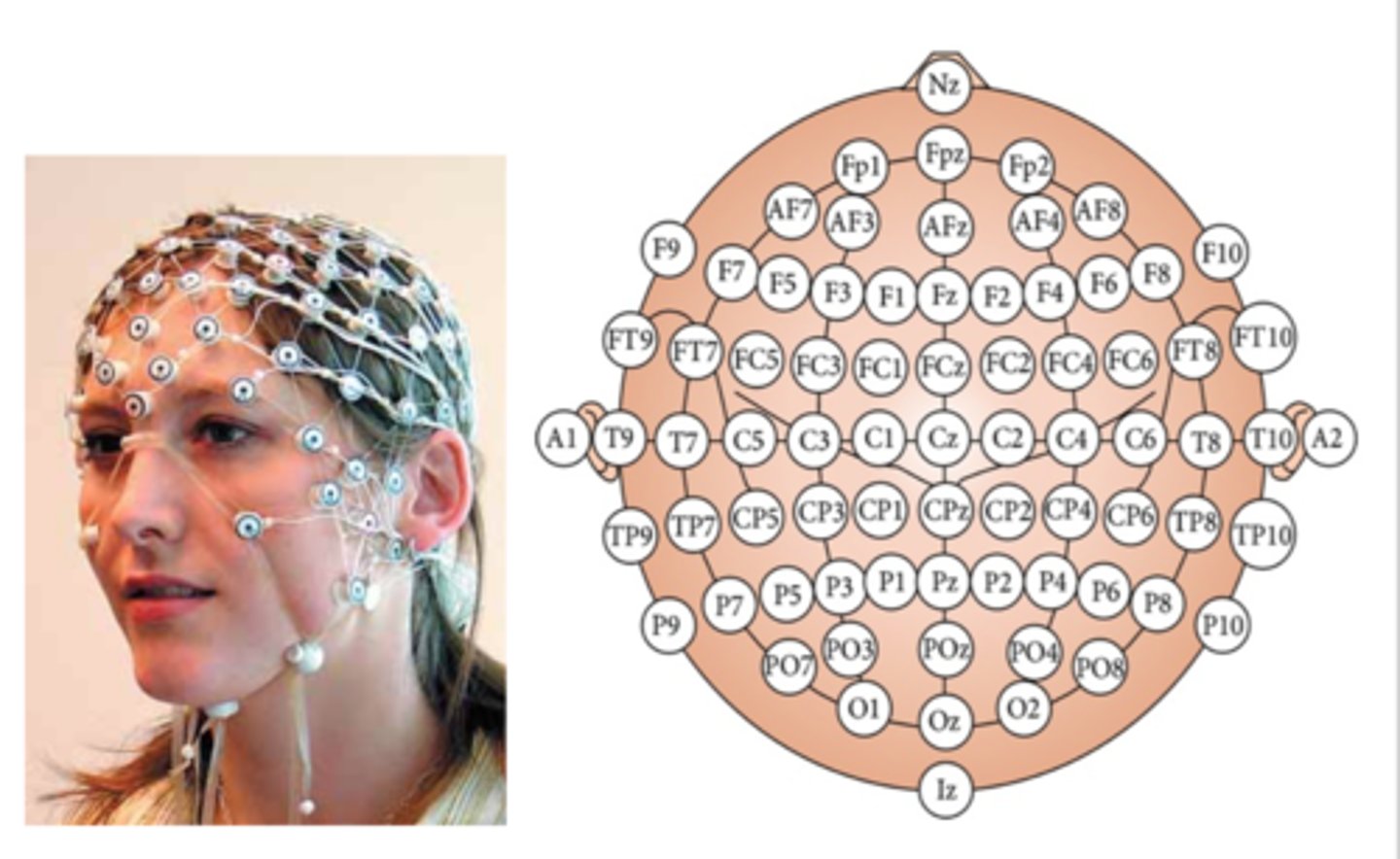 <p>electrode placement system where electrodes along straight lines are placed 10% of the nasion to inion distance from one another</p>