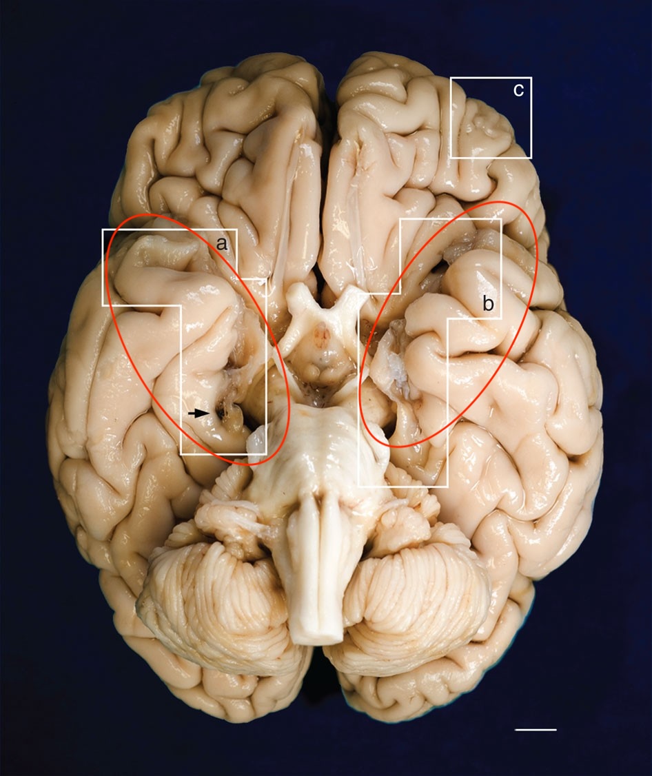 <p>Plays important role in memory encoding and retrieval</p>