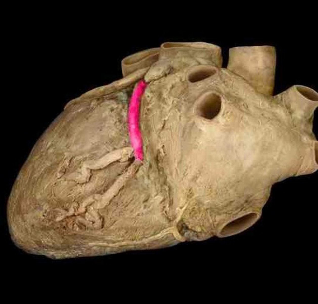 <p>artery</p>
