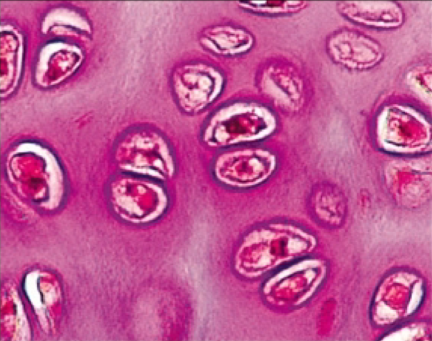 <p>What is the function of the Hyaline Cartilage (Connective Tissue)?</p>