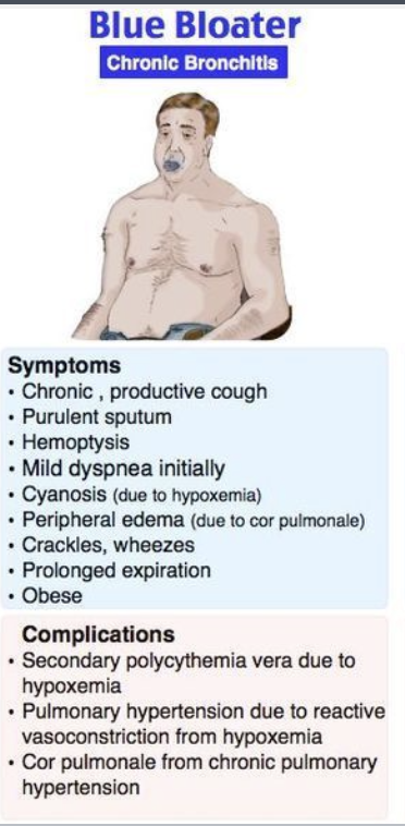 <p>Describe a blue bloater (chronic bronchitis)</p>