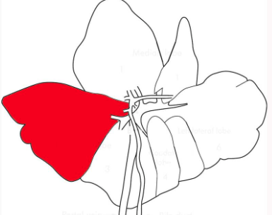 <p>Describe this distribution</p>