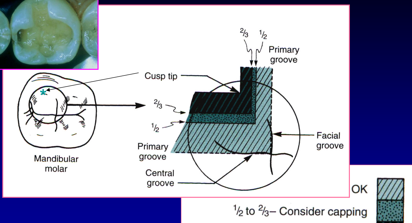 <p>½ - 2/3 depth </p>