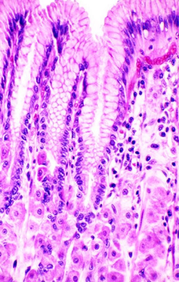<p>surface mucous cells</p>