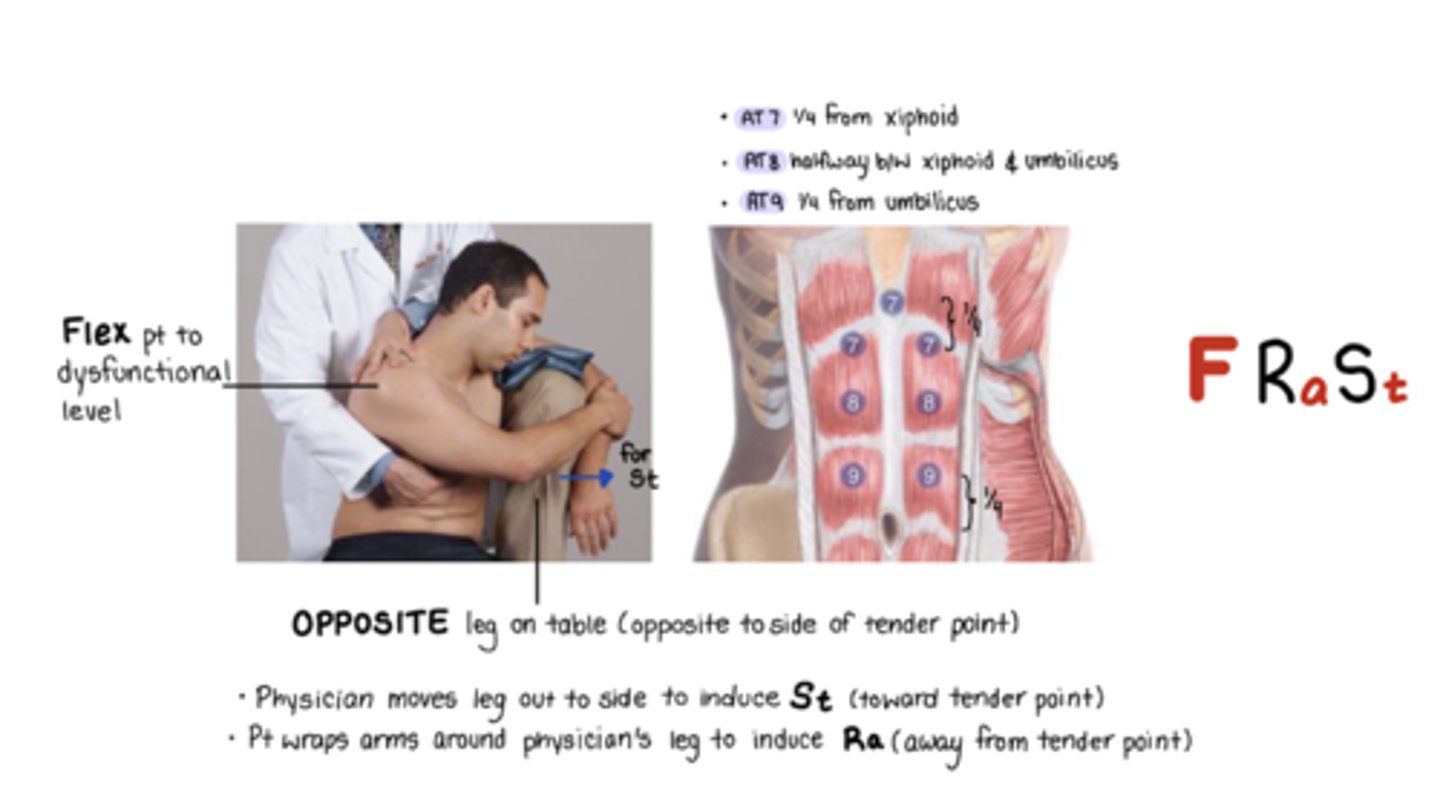 <p>F Ra St</p><p>1/4 from xiphoid process</p><p>St = move leg out to induce pt side bending toward TP</p><p>Ra = pt wraps arm around physicians leg to induce Ra from TP</p>