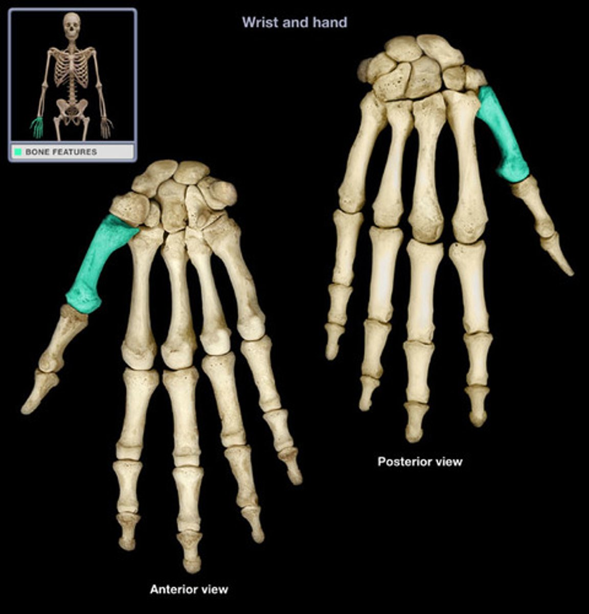 <p>MC1 is the metacarpal bone of the thumb, which is typically shorter and thicker than the others.</p>