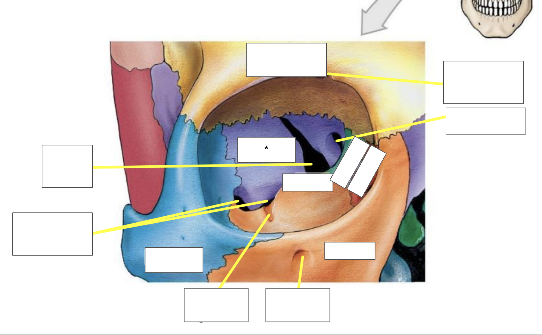 term image
