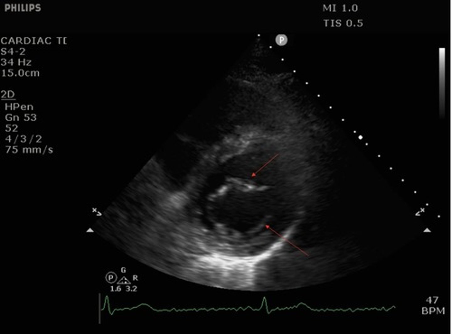 <p>What structures are indicated by the red arrows?</p>