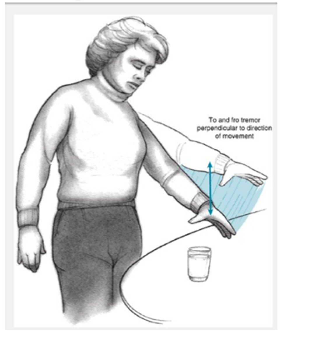 <p>Involuntary trembling when an individual attempts a voluntary movement</p>