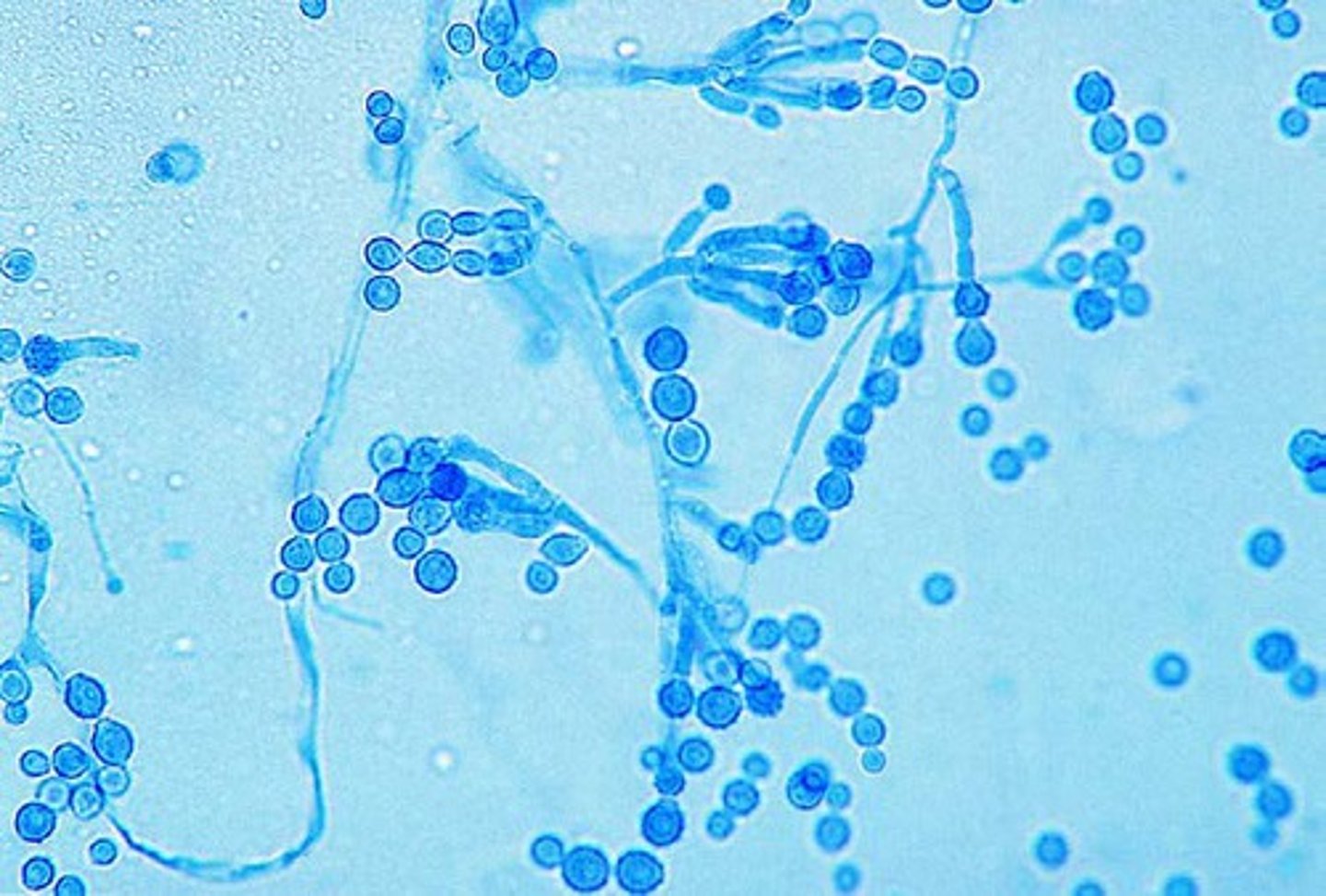 <p>Rapid; 2-3 days</p><p>Velvety, rugose, white then tan-brown</p><p>Reverse: brown</p><p>Microscopic: penicillium-like anelides support large, lemon-shaped anelloconidia that have spines (with age)</p><p>Conditions: keratomycosis</p>