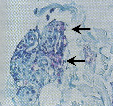 <p>doesn’t grow on traditional culture media. grows on food pads of armadillos. acid-fast bacteria present inside lepra cells, which are modified mononuclear cells</p>