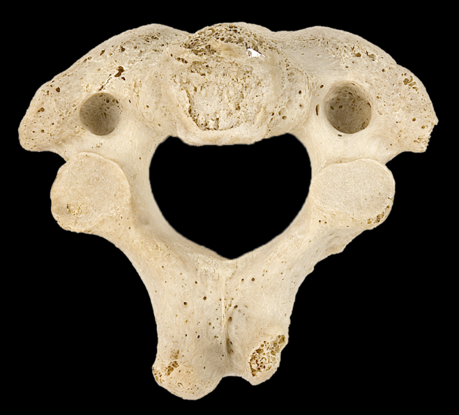 <p>Which bone is this?</p><p>(Inferior view).</p>