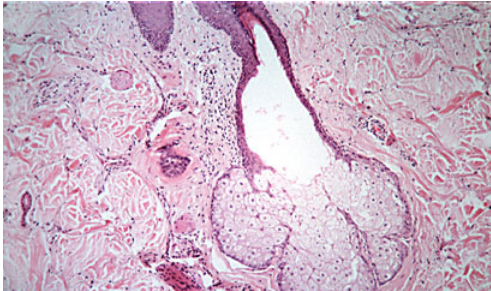 <p>How does holocrine secretion occur in sebaceous glands?</p>