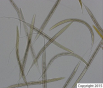 <p>small strongyles of the horse</p>