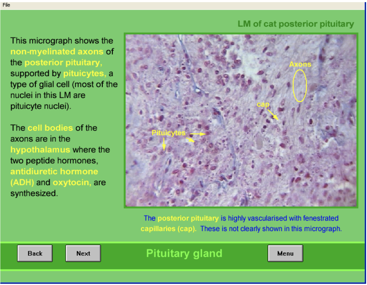 <ul><li><p>non-meylinated axons</p><ul><li><p>cell bodies are in hypothalamus, supraoptic and paraventricular nuceli</p><ul><li><p>where ADH (supraoptic) and oxytocin (paraventricular) are made</p></li></ul></li></ul></li><li><p>supported by pituicytes→ type of glial cell</p><ul><li><p>most nuclei in this are from these</p></li></ul></li><li><p>Highly vascularised</p><ul><li><p>fenestrated capillaries (not clearly shown here)</p></li></ul></li></ul><p></p>