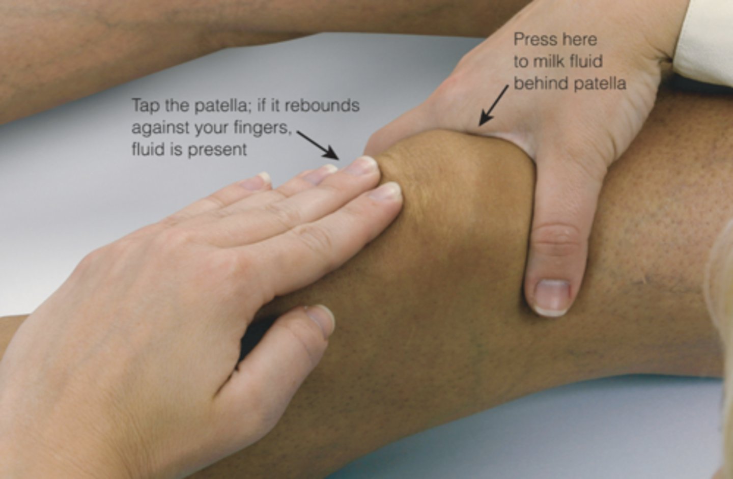 <p>a palpation technique used in detecting or examining a floating object in the body</p>