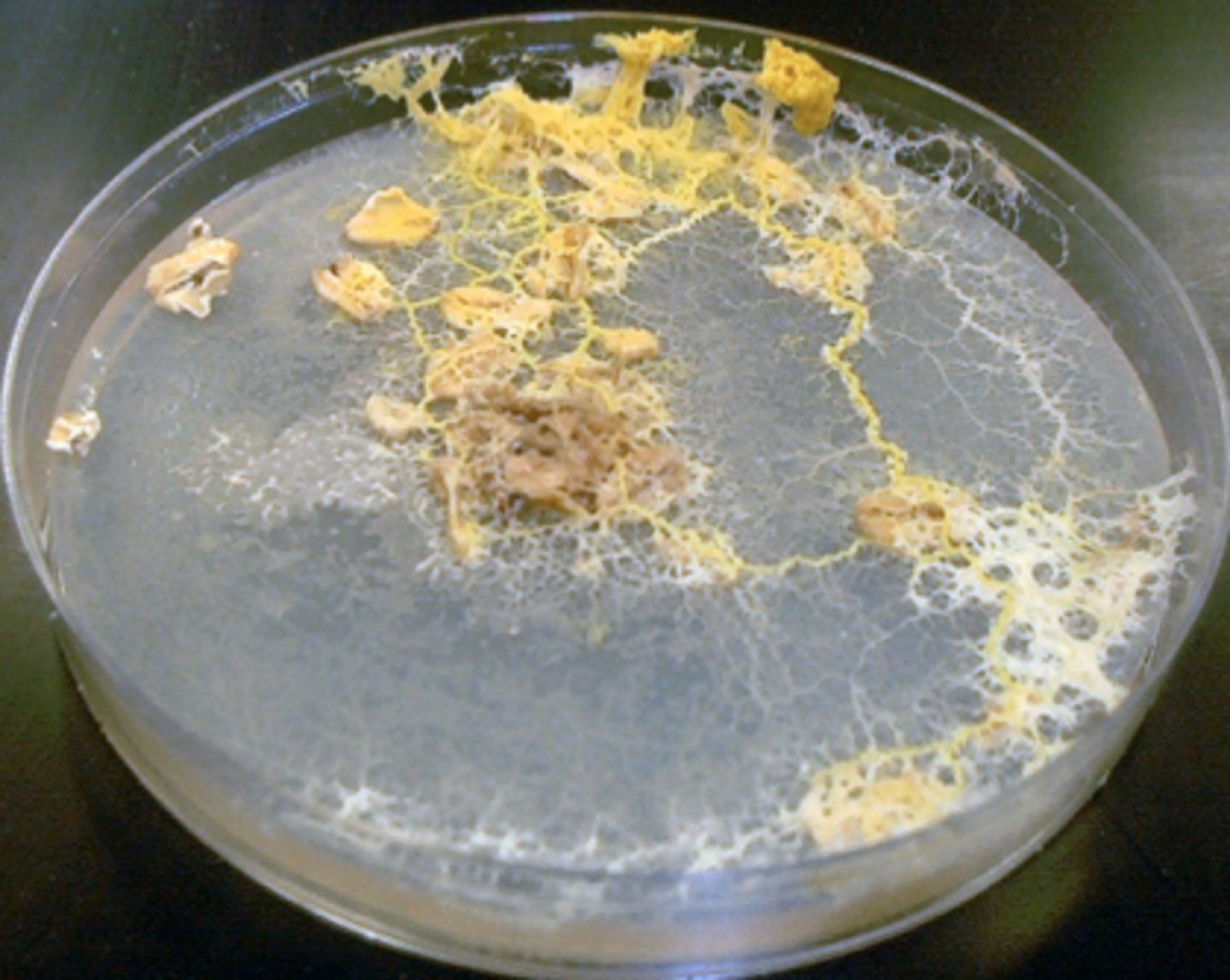 <p>Multinucleated cell (supercell), lack of cell membranes between nucleus, and is mobile</p><p>3 multiple choice options</p>