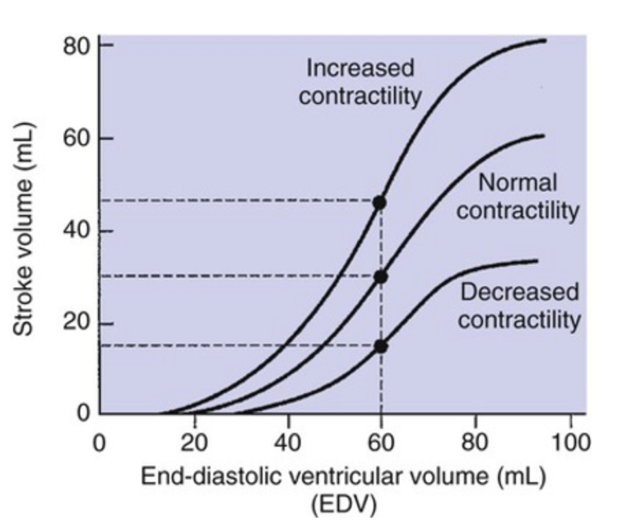 After recovering and returning to normal contractility, this same patient with a baseline EDV of 60 mL is treated with the negative inotropic agent *acetylcholine*. What is his new SV?