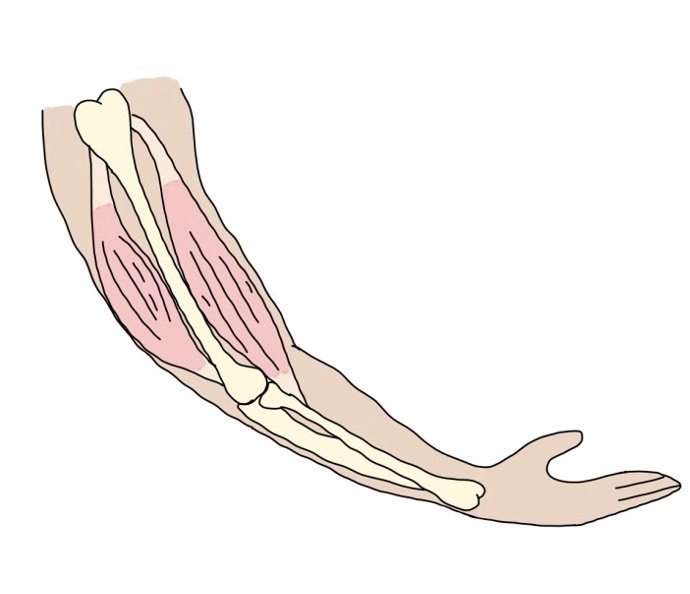 <p>Relaxed or contracted muscle?</p>
