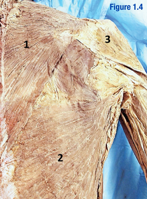 <p>Muscle lateral to trapezius</p><p>Origin: Lateral 1/3 of clavicle, acromion, spine of scapula</p><p>Insertion: Deltoid tuberosity of humerus</p><p>What number in the diagram?</p>