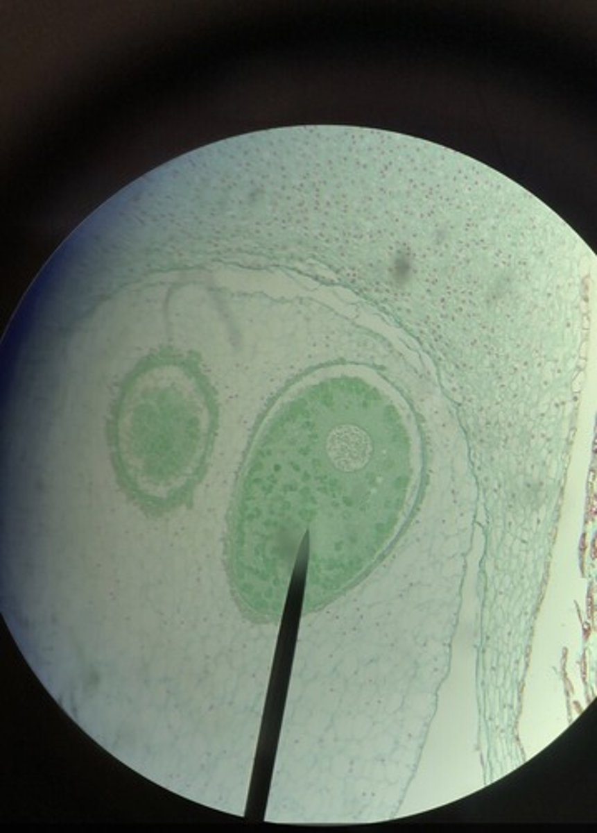 <p>Female reproductive organ that produces female gametes in mosses and ferns.</p>
