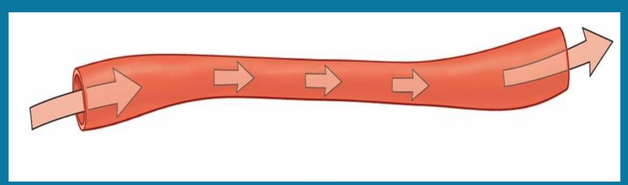 <p>IS this constriction or dilation?</p>