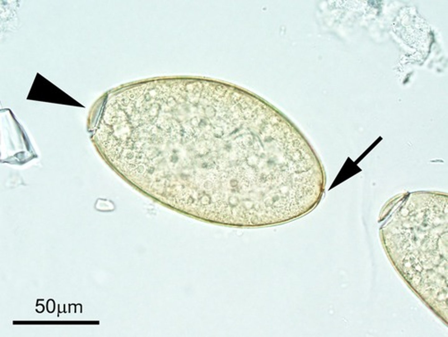 <p>Host: Cattle, Sheep, & other Ruminants</p><p>1st I. Host = aquatic snail, 2nd I. Host = none</p><p>(encyst on aquatic vegetation)</p>