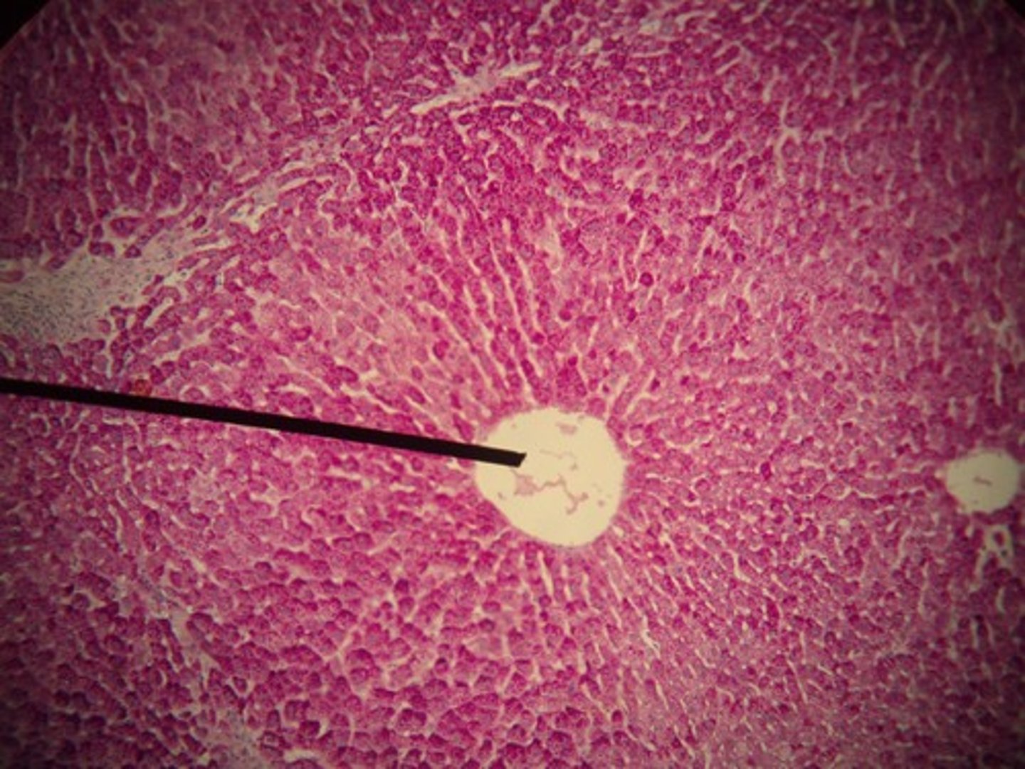 <p>The vein that collects blood from the liver lobules.</p>