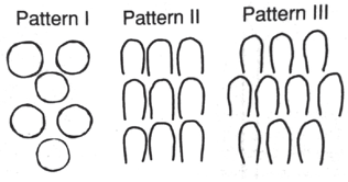 <ul><li><p>Pattern 1 - DEJ and Surface (formed slowly)</p></li><li><p>Pattern 3 - Keyhole patterns </p><ul><li><p>Head - Occlusal (parallel to long axis)</p></li><li><p>Tail - Cervical (65-70 degree angulation to long axis)</p></li><li><p>4 Ameloblasts needed to make a single enamel rod</p></li></ul></li></ul><p></p>