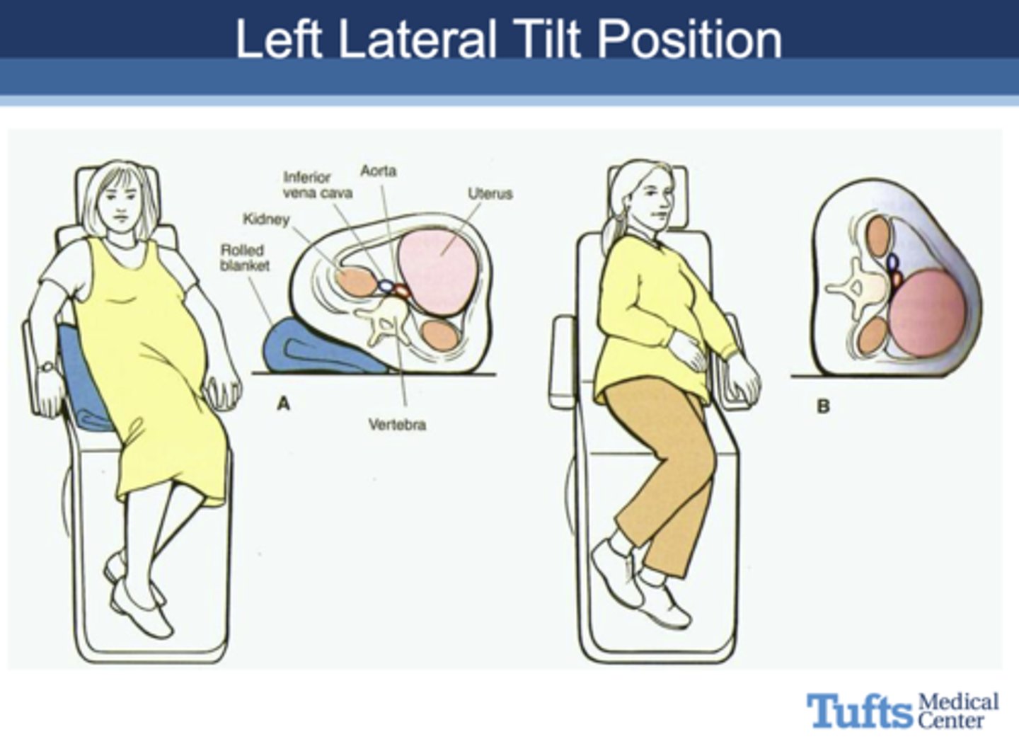 <p>Left Lateral Tilt Position</p>