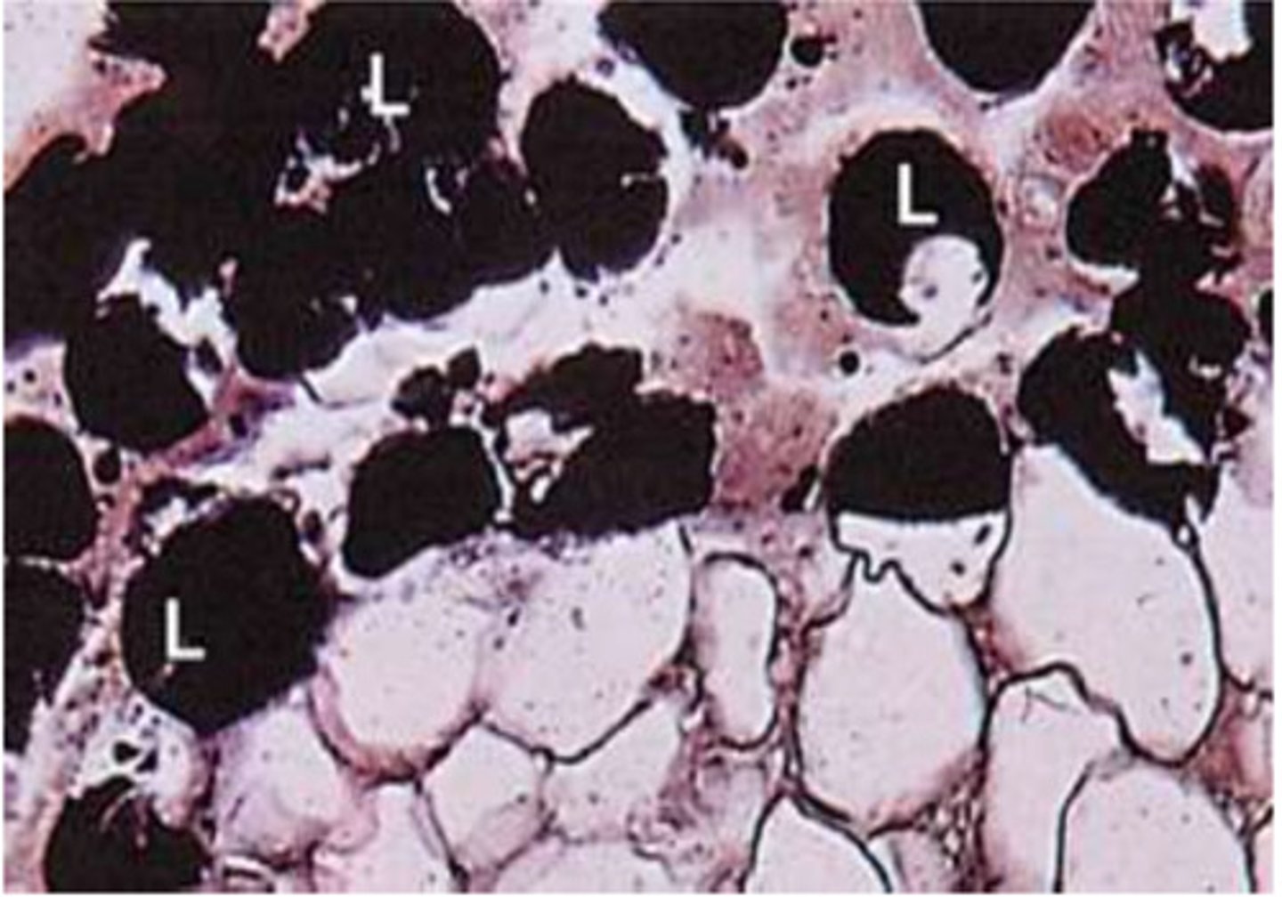 <p>lipids and myelin: black<br>nuclei and cytoplasm: red</p>