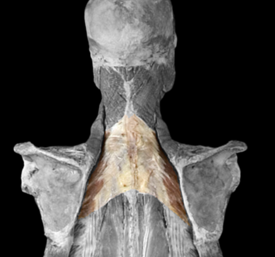 <p>What muscle is this?</p>